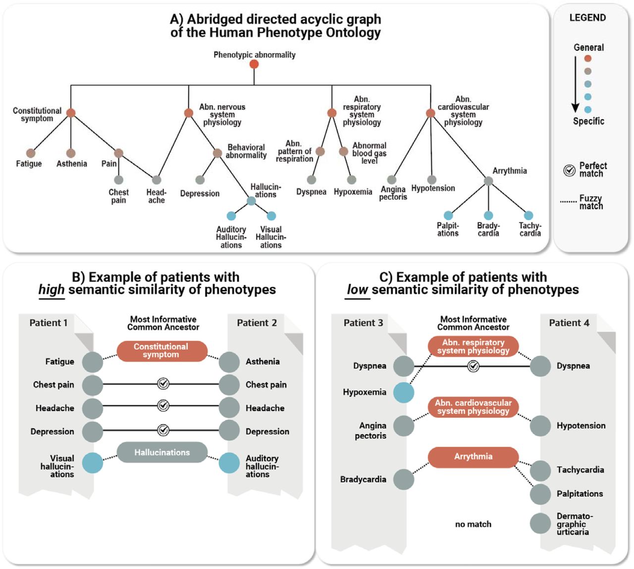 Calculating patient semantic similarity based on HPO phenotypes.A) HPO terms are arranged in a directed acyclic graph with specific terms such as Bradycardia (HP:0001662) being related to more general terms (here: Arrhythmia; HP:0011675) by subtype relations. An excerpt of the entire ontology (15,247 terms) is shown. B) Example showing a pair of patients with relatively high phenotypic similarity; for each of the HPO terms in patient 1, the best match is sought in patient 2. If an exact match is not found, the algorithm searches for the most informative common ancestor (MICA) in the ontology; the information content (a measure of specificity) of the exact matching term or most specific ancestor term is calculated to determine the specificity. For instance, Visual hallucinations (HP:0002367) and Auditory hallucinations (HP:0008765) are not an exact match, so the information content of their MICA Hallucinations (HP:0000738) is chosen. Hallucinations (HP:0002367) is still relatively specific (and shown in gray), while the MICA of Angina pectoris (HP:0001681) and Hypotension (HP:0002615) is more general (shown in red) and contributes less to the matching score. C) Example of a pair of patients with a relatively lower similarity due to (specific) fewer exact matches and one unmatched term. The pairwise similarity is calculated in this way for all pairs of patients to construct the similarity matrix that is used for clustering (Figure 3).