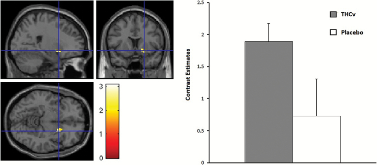 Left: Chocolate sight. Increase putamen activation under tetrahydrocannabivarin (THCv) compared with placebo, small volume corrected (svc) (z=2.74, P=.03 svc family wise error [FWE]-corrected for multiple comparisons). Right: Contrast estimates for putamen centered at 16 10 −6 for chocolate sight. Error bars show 1 SEM.