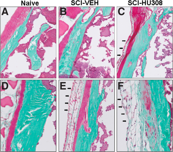 Representative histological staining of the periosteum from decalcified proximal tibiae in both treatment paradigms. Photomicrographs of Goldner's stain from acute treatment (A) naïve, (B) SCI-VEH, and (C) SCI-HU308 animals, and delayed treatment (D) naïve, (E) SCI-VEH, and (F) SCI-HU308 animals. Bar represents 50 μm. Arrows illustrate the fat deposition. SCI, spinal cord injury; VEH, in vehicle.