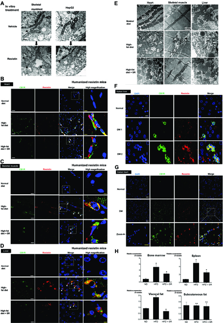 Insulin resistance facilitated by resistin may be associated with mitochondrial dysfunction induced by resistin. (A) Electron microscopic image of resistin treated human myoblast and hepatocellular carcinoma cells (HepG2) treated with resistin (50 ng/ml) for 3 h. It shows mitochondrial swelling, decreased matrix density, and distorted mitochondrial cristae in both cell types. Arrows indicate mitochondria. Scale bar, 100 nm. (B to D) The extent of the infiltrated cells secreting resistin was measured in target tissues such as the skeletal muscles, liver, and the heart. The high-fat diet-fed group showed increased number of resistin-positive cells in each organ, which was reversed by treatment with SR141716. Arrowheads indicate the cells that are positive for CB1R and resistin. Scare bars for immunofluorescence staining, 10 μm (for low power field) and 2.5 μm (for high power field). (E) Electron microscopy demonstrated that a high-fat diet changed the morphology of mitochondria into the swollen form, as seen in in vitro experiments. This change was reversed by treatment with SR141716. (F and G) Double immunofluorescence staining of human tissues such as the heart and liver between non-DM (normal) versus obese-DM (DM, diabetes mellitus) subject. Obese-DM subject showed a strong coexpression of infiltrated CB1R+ resistin+ monocytes (white arrows). Scare bars for immunofluorescence staining, 25 μm (for low power field) and 10 μm (for high power field). (H) Expression levels of resistin were measured in tissues of humanized resistin mouse models. Real-time PCR resistin in the bone marrow, spleen, visceral and subcutaneous fat of humanized resistin mice shows that high-fat diet group increased resistin expression that was reversed by SR141716 treatment (*P < 0.05, ND versus HFD, HFD versus HFD + SR; n.s., not significant; n = 4).