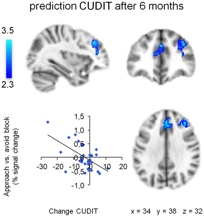 Association approach-bias activation patterns and change in cannabis problem severity.Approach-bias activation patterns in right dorsolateral prefrontal cortex and anterior cingulate cortex are negatively associated with changes in cannabis problem severity (CUDIT-scores) among heavy cannabis users at six-month follow-up. Scatter plot shows association change in CUDIT-scores and average percent signal change extracted from significant clusters. Clusters of significant activation (Z >2.3, whole-brain cluster-corrected at p<0.05) are overlaid on a standard MNI brain. Right side of the brain is depicted at right side.