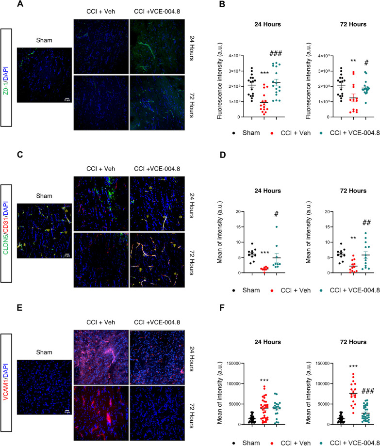 Effect of VCE-004.8 treatment on BBB integrity after TBI. A-C-E Representative immunofluorescence images and quantification B-D-F showing the expression of ZO-1, CLDN5 and VCAM1 in the ipsilateral corpus callosum at 24 h and 72 h after the brain injury. Data are represented as mean ± SEM, and significance was determined by one-way ANOVA followed by the Tukey’s post hoc test or Kruskal–Wallis post hoc test. B (24 h: p = 0.0003; ***p < 0.001, 72 h: p = 0.0073; **p < 0.01 CCI + Vehicle vs Sham; 24 h: p < 0.0001; ###p < 0.001, 72 h: p = 0.0408; #p < 0.05 CCI + VCE-004.8 vs CCI + Vehicle), D (24 h: p < 0.0001; ***p < 0.001, 72 h: p = 0.0086; **p < 0.01 CCI + Vehicle vs Sham; 24 h: p = 0.0180; #p < 0.05, 72 h: p = 0.0090; ##p < 0.01 CCI + VCE-004.8 vs CCI + Vehicle), F (24 h and 72 h: p < 0.0001; ***p < 0.001 CCI + Vehicle vs Sham; 72 h: p < 0.0001; ###p < 0.001 CCI + VCE-004.8 vs CCI + Vehicle). Scale bars equivalent to 25 µm