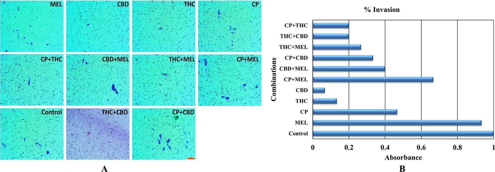 Demonstration of the effects of the tested combinations on the invasion of the MG63 cancer cell line using cell invasion measurement (A). Absorbance values of stained invasive cells measured at 560 nm (B). Bar 50 µm