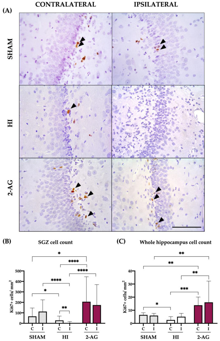 Ki67-positive cells in the SGZ and whole hippocampus after HI and subsequent 2-AG treatment at P14. (A) Representative microphotographs of Ki67+ cells in the contralateral and ipsilateral SGZs from sham, HI non-treated, and 2-AG-treated rat pups. Positive cells are identified with black arrows. Images were taken at 40× magnification (Scale bar: 100 μm). (B) In the SGZ, HI induced a decrease in the number of Ki67+ cells in the ipsilateral hippocampi (** p < 0.01 vs. HI-C; **** p < 0.0001 vs. sham-I). Contralateral counts from HI animals also showed reduced proliferation after HI (* p < 0.05 vs. sham-C). 2AG-treated animals showed higher Ki67 cell counts in contralateral SGZ compared to sham (* p < 0.05) and HI (**** p < 0.0001). Importantly, 2AG showed higher Ki67 cell counts in the ipsilateral SGZ (**** p < 0.0001) when compared to non-treated animals. (C) In the whole hippocampus, HI reduced cell proliferation in the contralateral side (* p < 0.05 vs. sham). 2AG-treated animals revealed higher Ki67 cell counts in both contralateral (** p < 0.01 vs. sham-C; *** p < 0.001 vs. HI-C) and ipsilateral (** p < 0.01 vs. sham-I; ** p < 0.01 vs. HI-I) hippocampi.