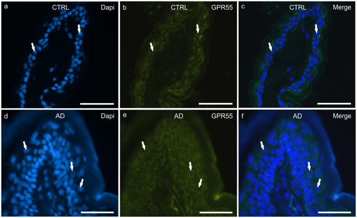 Photomicrographs of cryosections of canine skin showing G protein-coupled receptor 55 (GPR55) immunoreactivity (IR) in the tissues of the healthy dogs (CTRL) (a–c) and in the dogs with atopic dermatitis (AD) (d–f). (a–c) The white arrows indicate the DAPI-labeled nuclei of the keratinocytes showing moderate cytoplasmic GPR55-IR. (d–f) The white arrows indicate some DAPI-labeled nuclei of the cells of the suprabasal layer showing moderate-to-bright GPR55-IR. Bar, 50 μm.