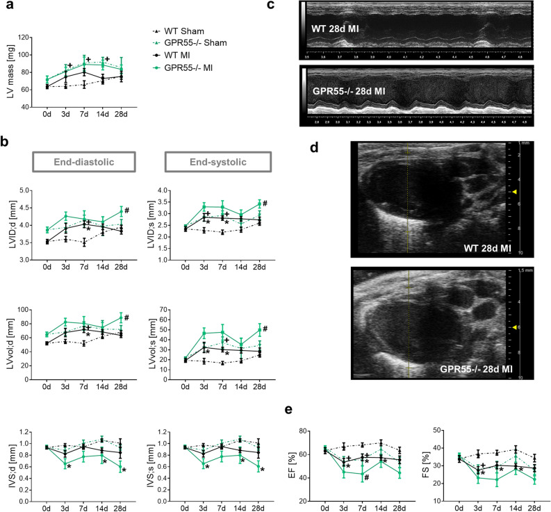 Impact of GPR55 deficiency on structural and functional maladaptive remodelling following MI. (a) LV mass, (b) diameter, volume and IVS thickness acquired by echocardiographic analyses of WT and GPR55−/− mice under basal conditions (0 day) and 3, 7, 14 and 28 days post-MI/sham surgery. (c) Representative long-axis M-mode and (d) B-mode projections at 28 day post-MI in WT and GPR55−/− mice. (e) LV function of WT and GPR55−/− mice under basal conditions (0 day) and 3, 7, 14 and 28 days post-MI/sham surgery. 0 day values of WT and GPR55−/− mice before MI induction are the same data as displayed in Fig. 1a and Table S1 as baseline data. Circles and triangles indicate mean ± SE (n = 7–14/group). *p < 0.05 vs. corresponding Sham, #p < 0.05 vs. corresponding WT; +p < 0.05 GPR55−/− Sham vs. WT Sham (Two-way ANOVA with Sidak’s post hoc test).