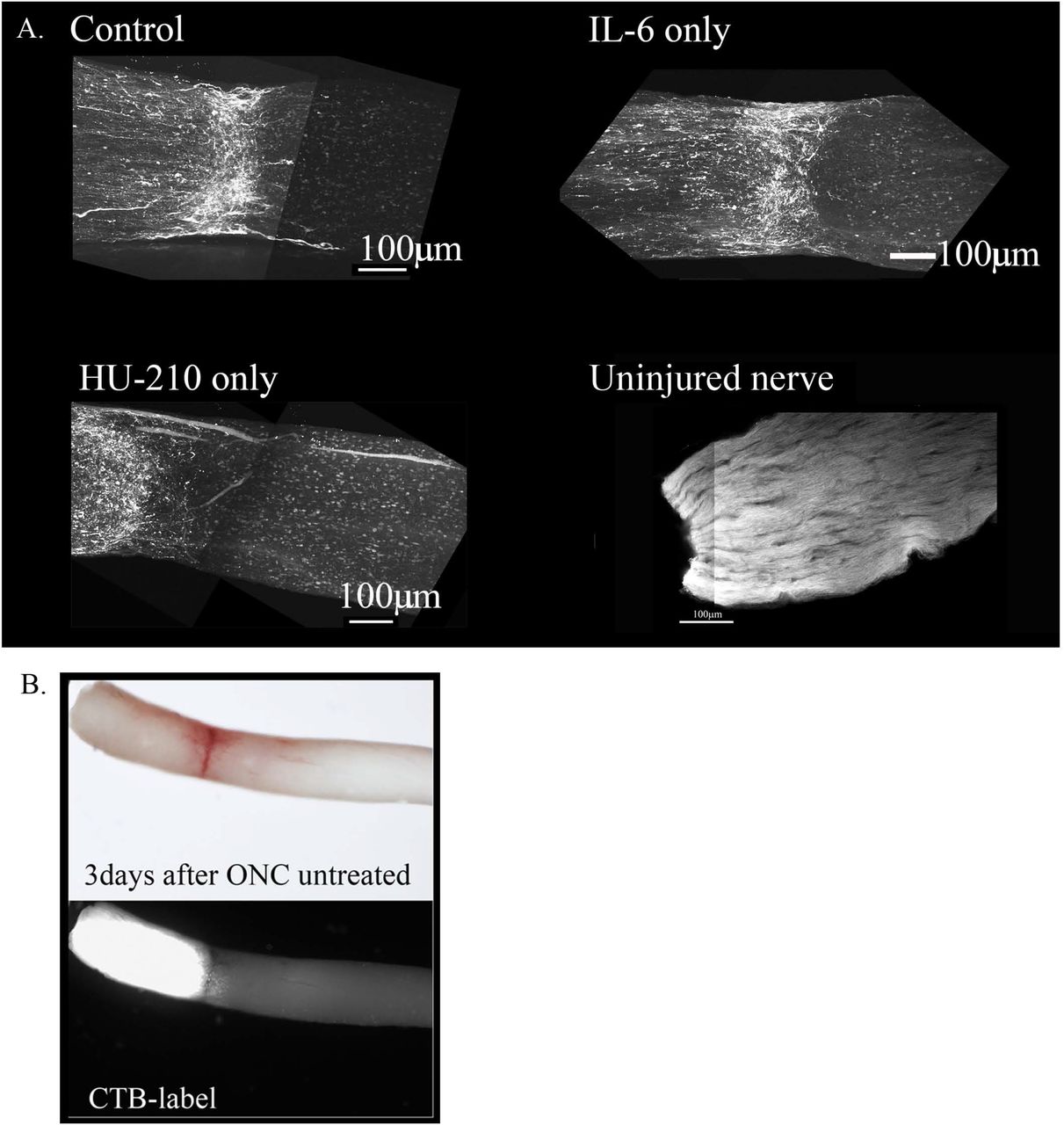 Regeneration after ONC in response to individual or a combination of drugs.(A) Using the rat ONC model and retrogradely labeling regenerating axons with Cholera Toxin B (CTB) by intravitreal injections into the retina 3 days prior to sacrificing and then chemical clearing using the 3-DISCO technique, we were visualizing the whole nerve and not just sections using a Multiphoton microscope. A. Control animals injected with 2.5 μl 0.5% DMSO, have few labeled axons crossing a short distance (less than 0.2mm from the crush site), this was consistent for IL-6 (5 mg/ml) and HU-210 (300 μM) evaluated individually as well, where no significant axonal regeneration was detected past the crush site. Uninjured nerve with CTB labeling and 3-DISCO clearing shows the abundance of axons in the rat optic nerve. (B) Untreated crushed optic nerve was labeled with CTB immediately after injury and 3 days after crush we viewed the nerve under the light microscope (top image), and the CTB-label under fluorescence, showing no spared fibers (bottom image). (C) CTB-labeled regenerating axons within the whole nerve were detected after applying the 3-DISCO clearing technique. Control animals had clear crush sites with few fibers crossing three weeks after injury (C1). However, with IL-6 and HU-210 treatment we could detect CTB-labeled axons within the nerve bundle shown (C2), above the boxed panel is a magnified region demarcated by the red box, showing the extent of regenerating axons over 2 mm away from the crush site, as pointed out by the white arrows. We quantified the extent of axonal regeneration in these chemically cleared nerves labeled with CTB using ImageJ analysis (C3). (D) Taxol applied in gelfoam alone had promoted limited axonal regeneration. Adding Taxol gelfoam with IL-6 and HU-210 injections resulted in more robust growth, but still less than 1mm from the crush site. APC gelfoam alone also promoted modest axonal regeneration from the crush site. Slightly more robust growth is detected when we combine IL-6 and HU-210 with APC gelfoam. The CTB-labeled axons are growing towards the edge where the APC-gelfoam was applied. In the enhanced and inverted image of APC gelfoam demarcated by the red box, we show the crush site that was treated with APC-gelfoam over the injury site. The white arrow in the inverted image of the original emphasizes the crushed fibers that are regenerating, as determined by CTB-labeling.