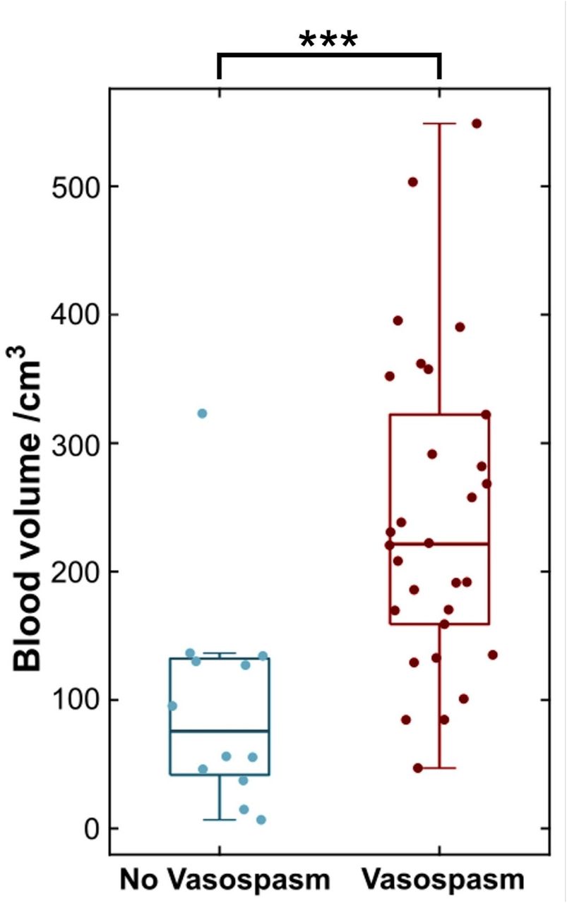 Greater segmented blood load is associated with greater radiological vasospasm risk.Boxplot of blood volume in patients who developed radiological vasospasm (maroon) and those who did not (blue). (*** = p< .001)