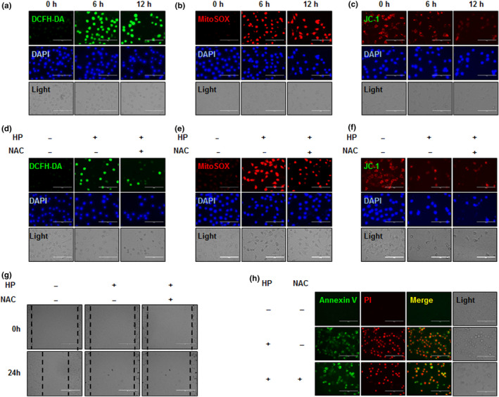 Effect of hemp peptides on cellular and mitochondrial reactive oxygen species and mitochondrial membrane permeability in Hep3B cells. Hep3B cells were treated with 10 mg/ml hemp peptides for 0, 6, and 12 hr. (a) Cellular reactive oxygen species (ROS) levels were detected by DCFH‐DA (green) and DAPI (blue) staining. (b) Mitochondrial ROS levels were measured by fluorescence microscopy using MitoSOX (red) and DAPI (blue) staining. (c) Mitochondrial membrane potential (MMP) was detected by JC‐1 assay. Hep3B cells were pretreatment with 5 mM NAC for 30 min prior to 10 mg/ml hemp peptide treatment for 12 hr. (d) Cellular ROS levels determined by DCFH‐DA (green) and DAPI (blue) staining. (e) ROS levels at the mitochondria were measured by fluorescence microscopy using MitoSOX (red) and DAPI (blue) staining. (f) Mitochondrial membrane potential detected by JC‐1 assay. (g) Cell migration determined by wound healing assay. (H). Apoptosis levels determined by fluorescence microscopy of Annexin V‐FITC (green) and PI (red). Scale bars represent 100 μm for all images