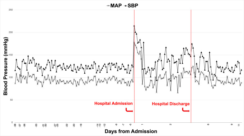Blood pressure readings (MAP mean arterial pressure, SBP systolic blood pressure) prior to hospital admission, during hospital admission, and post-discharge. Increased blood pressure is noted on hospital admission compared with patient’s baseline, which normalized over the course of days upon resolution of retching