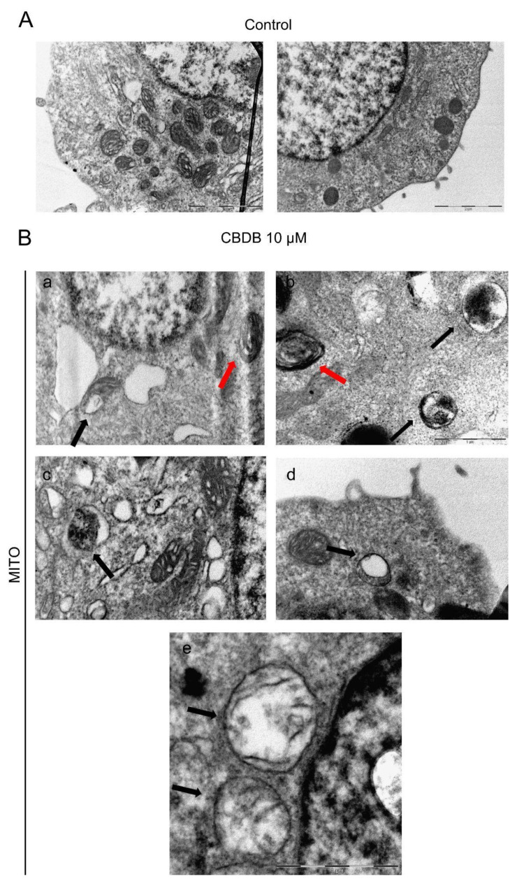 Representative TEM images of cell morphology. (A) MCF-7 control cells (treated with DMSO as a vehicle). Scale bar 2 μm. (B) MCF-7 cells exposed to CBDB or CBDP (10 µM) for 24 h. Mitochondria with dilated cristae (panel a,b, red arrows); swollen mitochondria with crests in the process of breaking (panel a–e; black arrows). Scale bar 1 μm.
