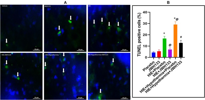 DNA fragmentation detection in the rat brain following HI. (A) Representative images of TUNEL staining for DNA fragmentation (apoptosis) in the experimental groups. Arrows indicate TUNEL+ cells. (B) Graph represents percent TUNEL positive cells in the rat brain 7 days post HI. *P < 0.001 vs. placebo; @P < 0.05 vs. HIE + placebo; #P < 0.0001 vs. HIE + Hypothermia + Placebo.