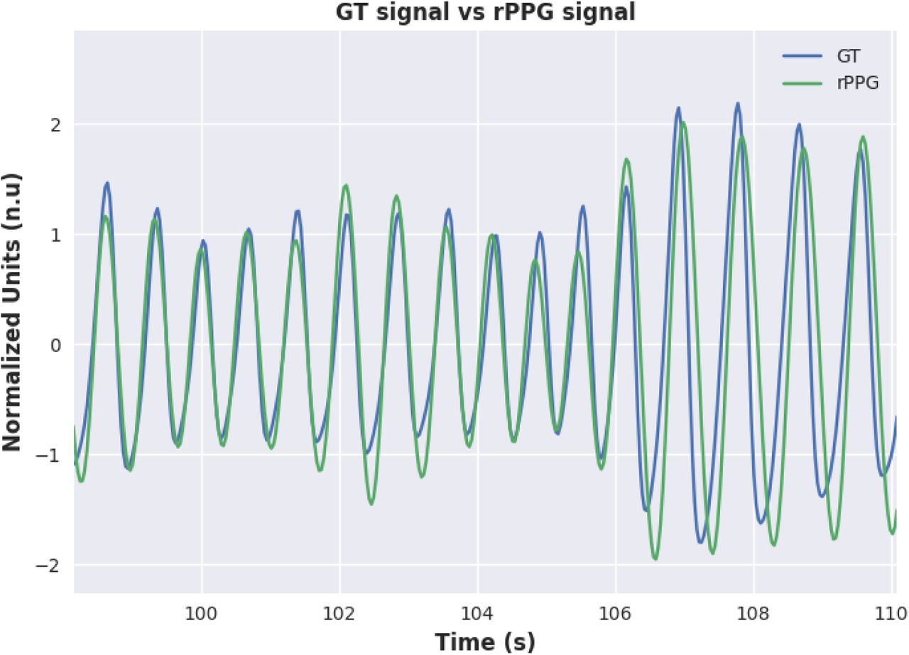 GT Signal vs. rPPG signal.