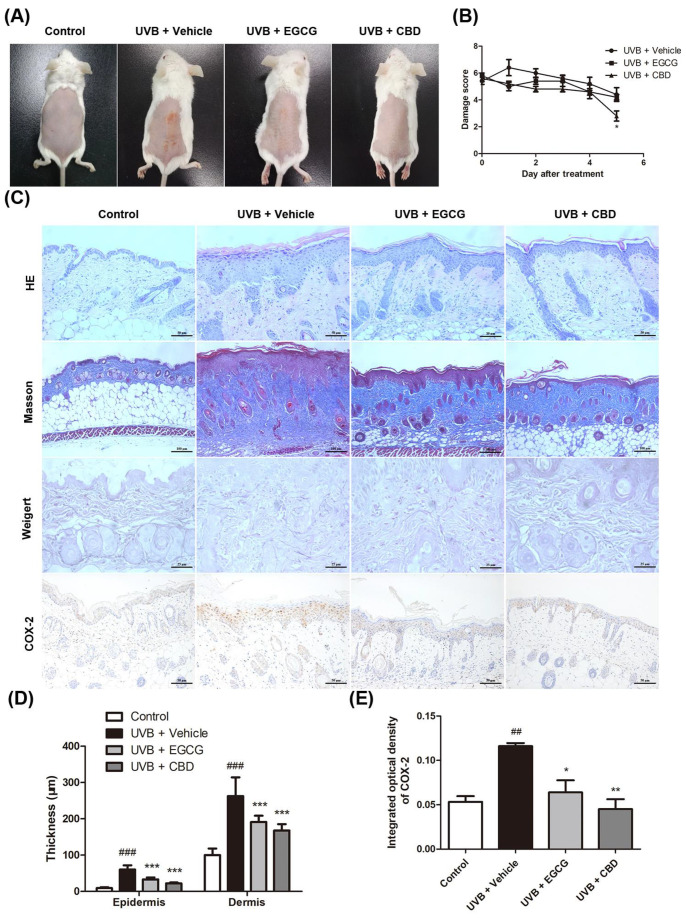 Protective effects of cannabidiol against skin photodamage in murine models: The backs of BALB/c mice were irradiated with UVB (120 mJ/cm2) once per day for 5 consecutive days, and then CBD or the vehicle was topically applied once per day for 5 days. The groups of mice were either (i) unexposed (control), (ii) exposed to UVB radiation and treated topically with CBD (0.1 mg/cm2) (UVB + CBD), (iii) exposed to UVB and treated with an equal amount of the vehicle (UVB + vehicle), or (iv) exposed to UVB radiation and treated topically with EGCG (0.75 mg/cm2) (UVB + EGCG). Skin biopsies were processed for staining 24 h after the last treatment. (A) Representative features of the dorsal skin 24 h after the last treatment. (B) Photodamage scores were obtained before the first treatment and 24 h after each treatment. (C) Hematoxylin and eosin (HE), Masson, and Weigert’s elastic-fiber staining of skin samples, along with immunohistochemical staining for COX-2, were performed. (D) The thickness of the epidermal and dermal layers and (E) the integrated optical density of COX-2 expressed as positive area % were measured using ImageJ software. Data are presented as the mean ± SD (n = 5); ## p < 0.01, ### p < 0.001 as compared with the control group; * p < 0.05, ** p < 0.01, and *** p < 0.001 as compared with the UVB-irradiated group.