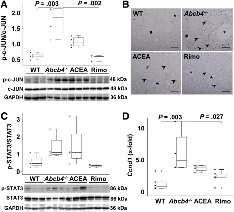 Rimonabant reduced the activation of c-JUN signaling as well as Ccnd1 in Abcb4-/-mice. (A) Western blot analysis showed the activation of c-Jun in Abcb4-/- mice and the reduction of hepatic c-JUN activation by rimonabant. (B) Immunohistochemistry showed more c-JUN–positive nuclei in hepatocytes of Abcb4-/- mice and a decrease of hepatocellular c-JUN activation (arrowheads) by treatment with rimonabant. ∗Portal vessels, #central veins. (C) The level of activation was not altered significantly among the groups. (D) Cholestasis-induced induction of hepatic Ccnd1 transcription in Abcb4-/- mice was normalized to WT level by rimonabant. (A, C, and D) One-way analysis of variance and post hoc Bonferroni tests were used for statistical analysis. n = 3–5 mice per group. One of 3 independent experiments of mRNA analyses is shown. For protein expression, representative data of 3 independent experiments are depicted. GAPDH, glyceraldehyde-3-phosphate dehydrogenase; p-c-JUN, phosho-cellular JUN; p-STAT3, phosho-signal transducer and activator of transcription 3; Rimo, rimonabant.