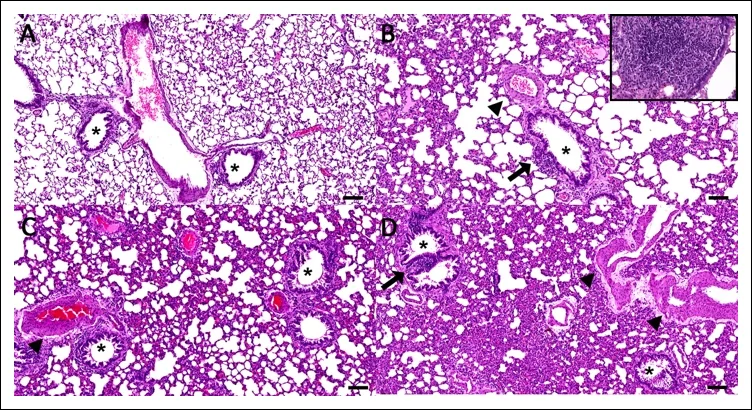 Histopathological changes in rat lungs following experimental cannabidiol vapor inhalation. (A) Control group exposed to saline vapor showing unremarkable alveolar and bronchial architecture (asterisk). (B) At 15 days, the pulmonary interstitium exhibits mild-to-moderate hypercellularity with inflammatory cell infiltration. Mild BALT hyperplasia is visible (arrow, inset), together with minimal pulmonary arterial smooth muscle hypertrophy (arrowhead). (C) At 30 days, interstitial pneumonia becomes more evident, with increased interstitial cellularity and mild vascular hypertrophy (arrowhead). (D) At 60 days, interstitial pneumonia is more pronounced, accompanied by Bronchus-associated lymphoid tissue hyperplasia (arrow) and moderate vascular hypertrophy (arrowheads). Hematoxylin and eosin stain. Asterisks indicate bronchi. Scale bars = 100 μm.