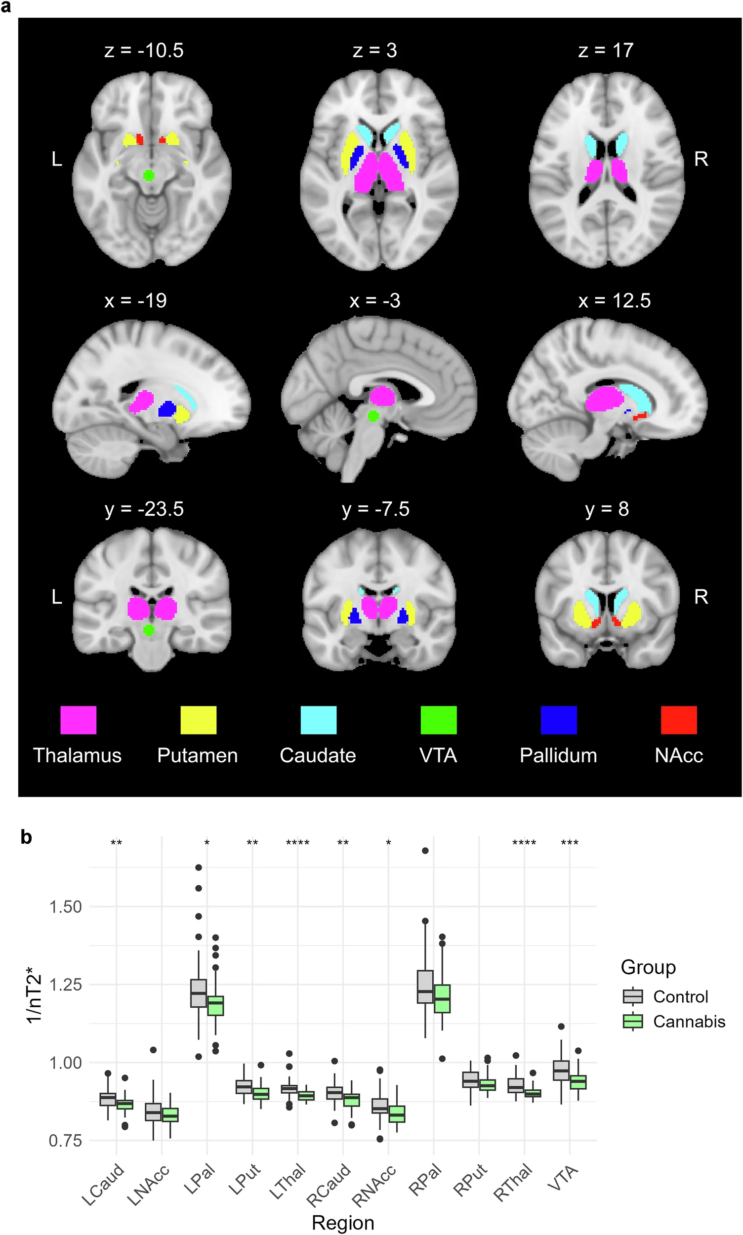 Characteristics of regions in which 1/nT2* was measured.a Regions in which 1/nT2* was evaluated due to expectation of dopamine presence. NAcc nucleus accumbens, VTA ventral tegmental area. b Boxplot depicting bivariate group differences in subcortical 1/nT2*. VTA ventral tegmental area, LNAcc left nucleus accumbens, RNAcc right nucleus accumbens, LCaud left caudate, RCaud right caudate, LPut left putamen, RPut right putamen, LThal left thalamus, RThal right thalamus, LPal left pallidum, RPal right pallidum. * p < 0.05; ** p < 0.01; *** p < 0.001.