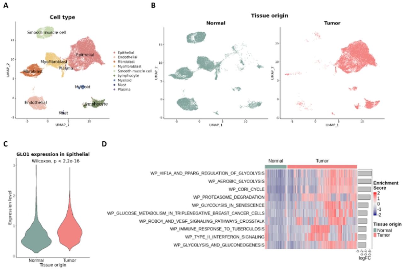 scRNA-seq Analysis of GLO1 Expression in Cervical Squamous Cell Carcinoma.(A) UMAP plot of 44,848 cells categorized by cell types. (B) UMAP distribution of 23,636 normal and 21,212 tumor cells. (C) GLO1 expression in epithelial cells from normal and tumor tissues, excluding cells not expressing GLO1. (D) Heatmap of GSVA enrichment scores for Wikipathways gene sets, comparing epithelial cells from normal and tumor tissues. The top 10 pathways are displayed based on the logFC of average GSVA scores between the two groups.