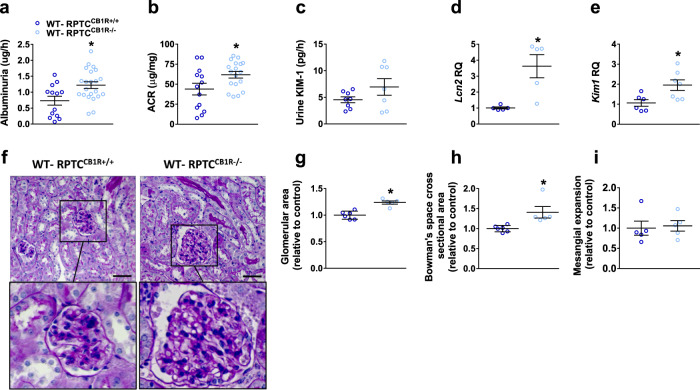 mTORC1 overactivation in RPTC-CB1R KO mice promotes kidney functional and morphological abnormalities.a Albuminuria in 16-week-old normoglycemic mice. n = 13 mice for WT-RPTCCB1R+/+, n = 22 mice for WT-RPTCCB1R−/− (*P = 0.0079). b Urine albumin-to-creatinine ratio (ACR) in 16-week-old normoglycemic mice. n = 13 mice for WT-RPTCCB1R+/+, n = 18 mice for WT-RPTCCB1R−/− (*P = 0.0301). c Urinary KIM-1 levels in 16-week-old normoglycemic mice. n = 8 mice for WT-RPTCCB1R+/+, n = 7 mice for WT-RPTCCB1R−/−. d qPCR analysis of the kidney injury marker, Lcn2. n = 5 mice per group (*P = 0.0070). e qPCR analysis of the kidney injury marker, Kim1. n = 6 mice for WT-RPTCCB1R+/+, n = 7 mice for WT-RPTCCB1R−/− (*P = 0.0197). f Representative PAS staining of the kidney, 40× magnification, scale bar: 50 µm. g Glomerular area quantification (at least 10 glomeruli per mouse). n = 6 mice for WT-RPTCCB1R+/+, n = 5 mice for WT-RPTCCB1R−/− (*P = 0.0004). h Bowman’s space cross-sectional area quantification (at least 10 glomeruli per mouse). n = 6 mice for WT-RPTCCB1R+/+, n = 5 mice for WT-RPTCCB1R−/− (*P = 0.0142). i Mesangial expansion quantification (at least 10 glomeruli per mouse). n = 6 mice for WT-RPTCCB1R+/+, n = 5 mice for WT-RPTCCB1R−/−. Data represent the mean ± SEM and were analyzed by Unpaired Two-tailed Student’s t-test. *P < 0.05 relative to the corresponding control groups. Source data are provided as a Source Data file.