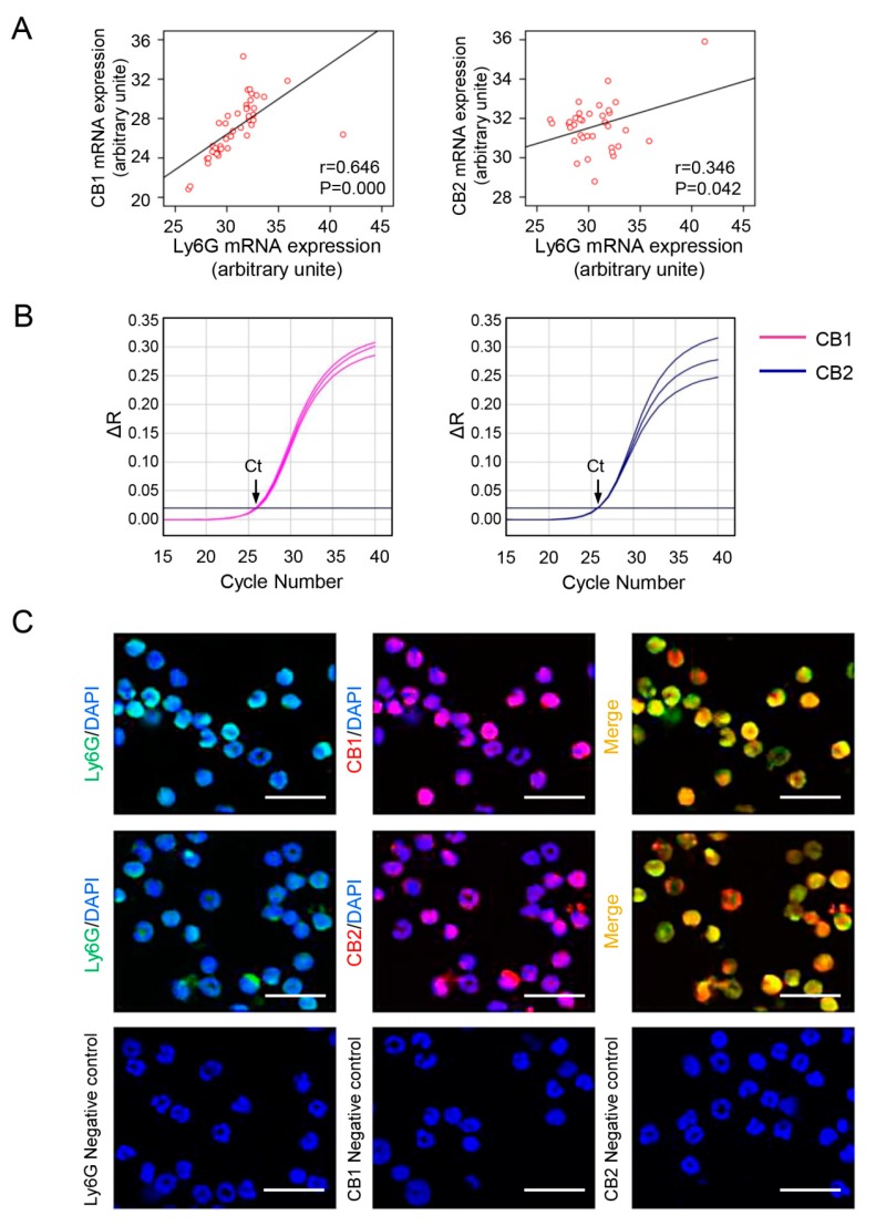 Cannabinoid receptor (CB) expression positively correlates with neutrophil signatures in CCl4-treated mice, and CBs are abundantly expressed in isolated neutrophils. (A) The correlation between Ly6G and CB1 or CB2 in liver tissue. (B) The amplification plots of CB1 and CB2 expression in neutrophils by RT-qPCR. (C) Representative images of immunofluorescent staining for Ly6G (green) and CB1 or CB2 (red) in neutrophils. The nuclei were stained with DAPI (blue). Scale bars, 20 μm. N = 6 per group.