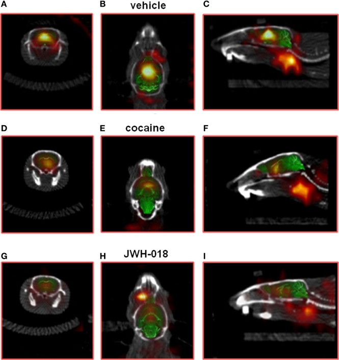 Sample slice from a [123I]-FP-CIT SPECT/CT image of a vehicle [(A–C); respectively, coronal, transverse, and sagittal plan], cocaine [(D–F); respectively, coronal, transverse, and sagittal plan], and JWH-018 [(G–I); respectively, coronal, transverse, and sagittal plan] treated mice. ROIs for the striatum.