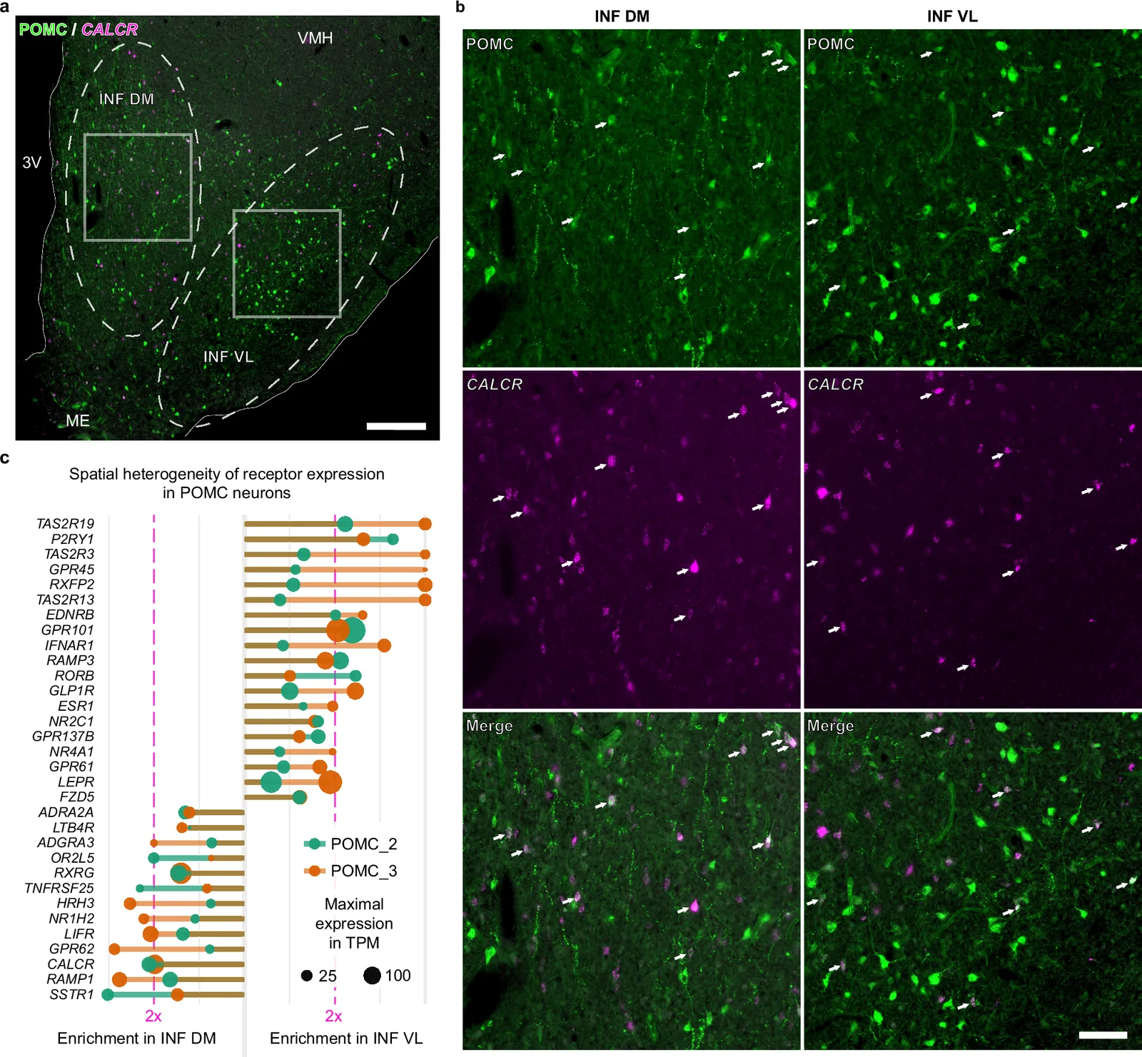 Spatial heterogeneity of the human POMC neuron transcriptome.According to plate 27 of Mai et al.15, POMC-IR neurons in the infundibular nucleus (INF) are organized into dorsomedial (DM) and ventrolateral (VL) anatomical subpopulations that differ in their gene-expression profiles. a, b RNAscope in situ hybridization detection of CALCR mRNA (magenta) in 21.14% and 11.76% of POMC neurons (green) in the DM and VL subregions of the INF, respectively. Arrows in (b), corresponding to the boxed areas in (a), indicate double-labeled neurons. c Preferential receptor gene expression in DM and VL POMC-IR cell groups, as revealed by IHC/LCM-Seq. Dot size indicates expression level in TPM in samples from two human subjects (POMC_2 and POMC_3; Samples #6 and #9, respectively, in Supplementary Data 3). Receptors were included if they showed ≥5 reads and ≥10 TPM in either the DM or VL group in both individuals, an absolute DM–VL log2 FC > 0.2 in each subject, and a mean absolute log2 FC > 0.5 across subjects. 3V 3rd ventricle, INF DM dorsomedial part of the infundibular nucleus, INF VL ventrolateral part of the infundibular nucleus, ME median eminence, VMH ventromedial hypothalamic nucleus. Scale bars: 400 µm in (a) and 100 µm in (b). For full transcriptomes, see Supplementary Data 16.